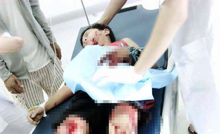 Cong an, quan doi truy nguon goc luu dan no nat tay be trai hinh anh