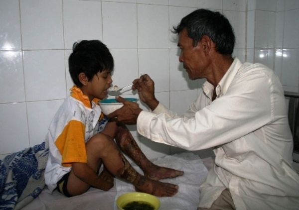 Cha dung rom dot chan con de de doa hinh anh