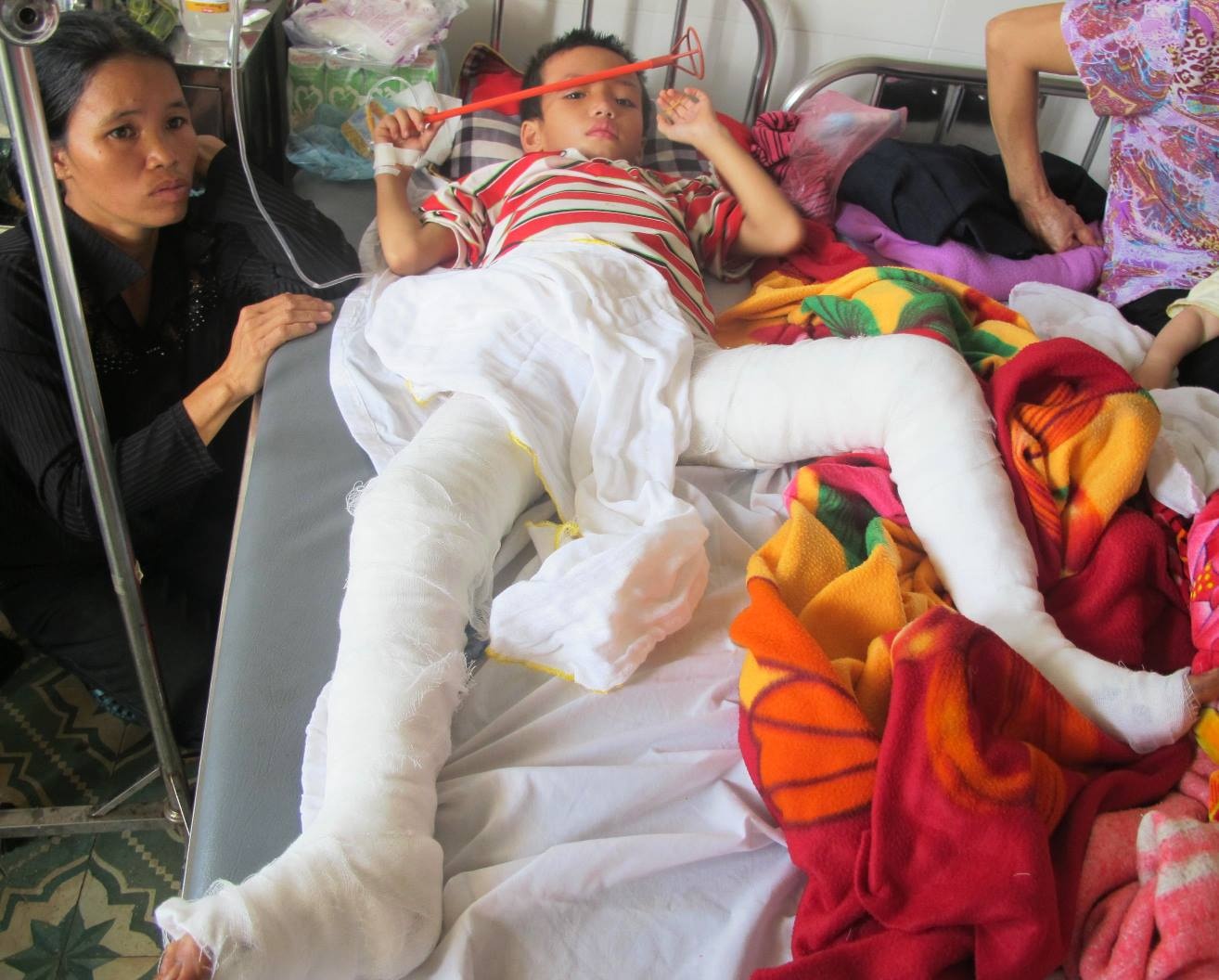 Cháu Vinh hiện đang được điều trị tại bệnh viện Sản - Nhi Nghệ An.