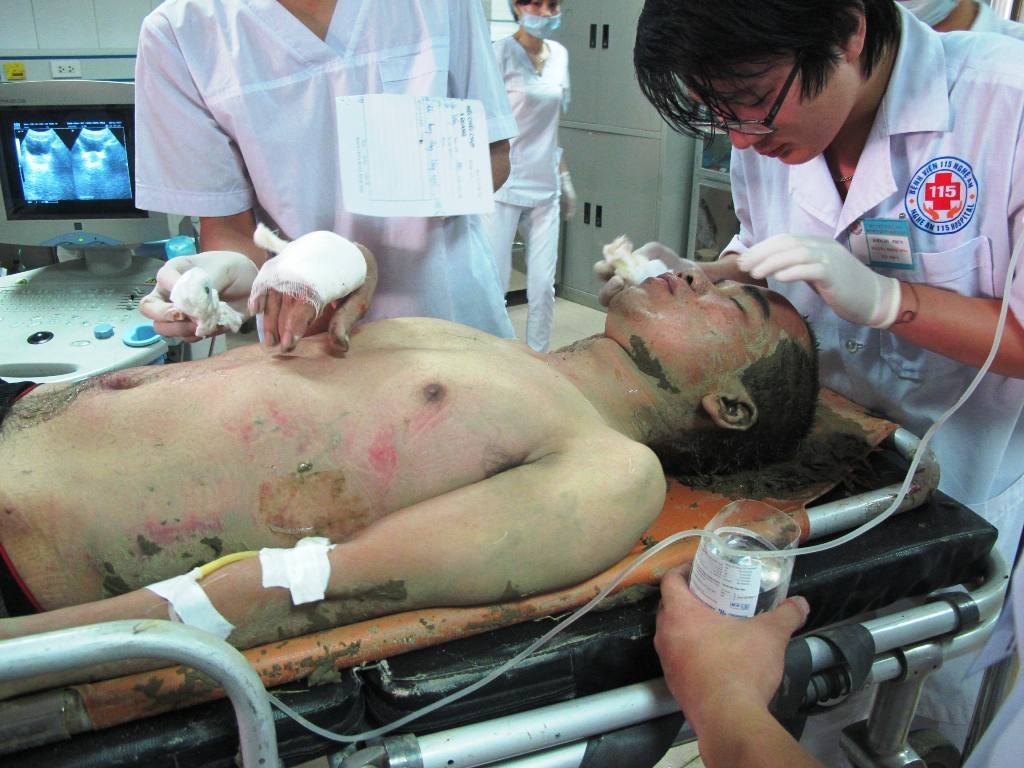 Nạn nhân bị thương đang được cấp cứu tại bệnh viện đa khoa 115 Nghệ An.