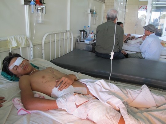 Che do choi, thieu nien bi pin no nat ban tay, hu mat hinh anh