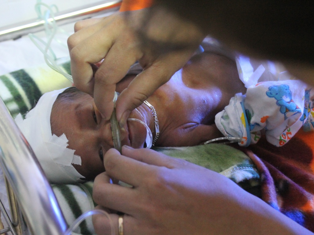 Thai nhi 7 thang song sot sau ca de roi xuong ho nha ve sinh hinh anh