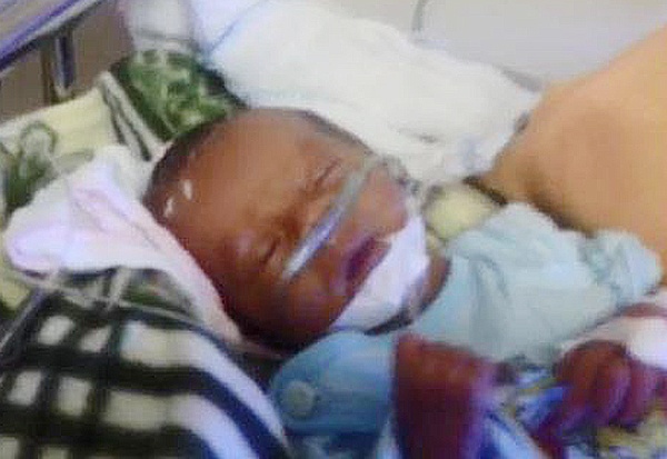 Dua be trai de roi trong ho nha ve sinh ra Ha Noi dieu tri hinh anh