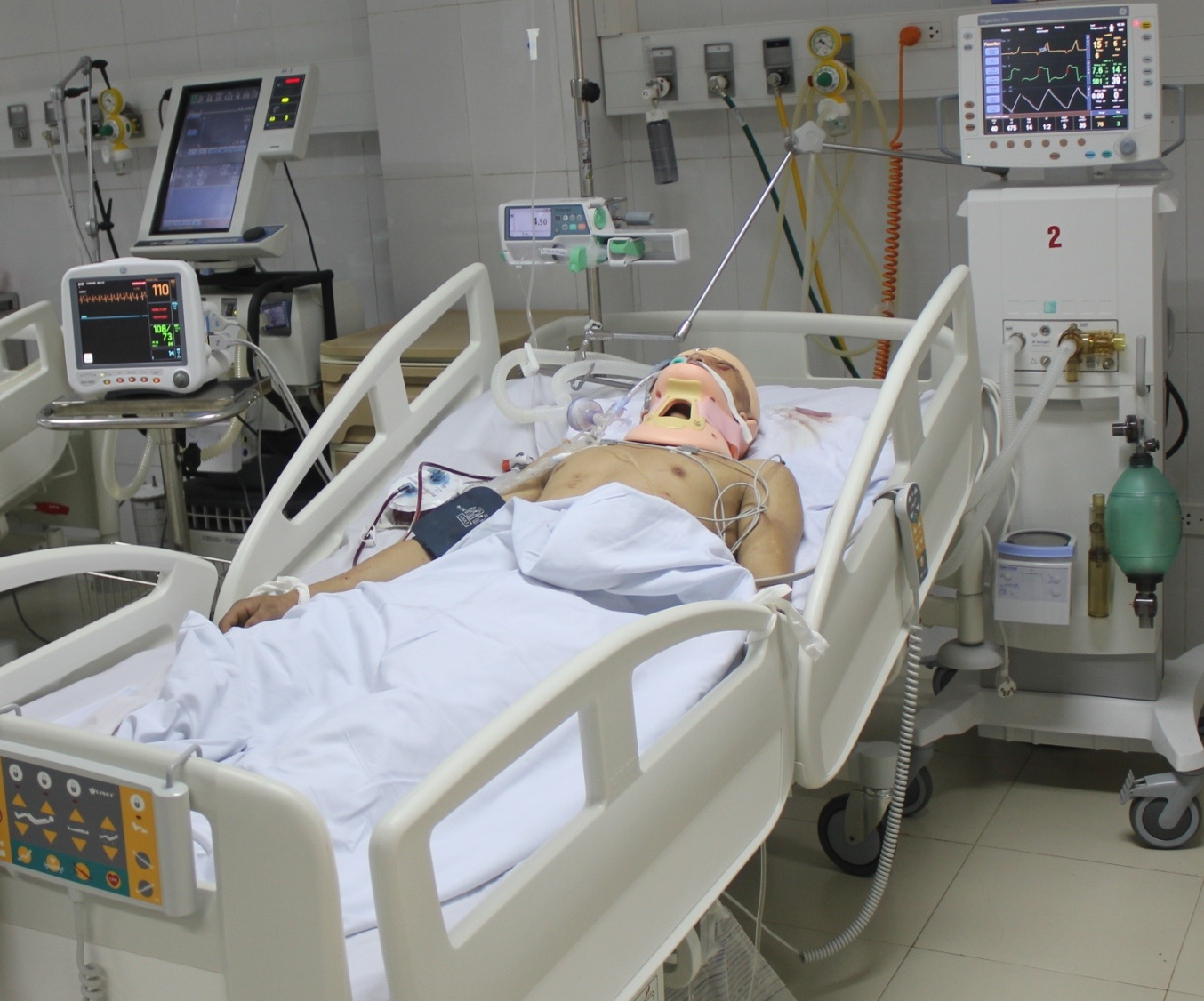 Nguyễn Văn Lưu đang được cấp cứu tại bệnh viện đa khoa Nghệ An. Bác sĩ tiên lượng tình trạng bệnh nhân nguy kịch.