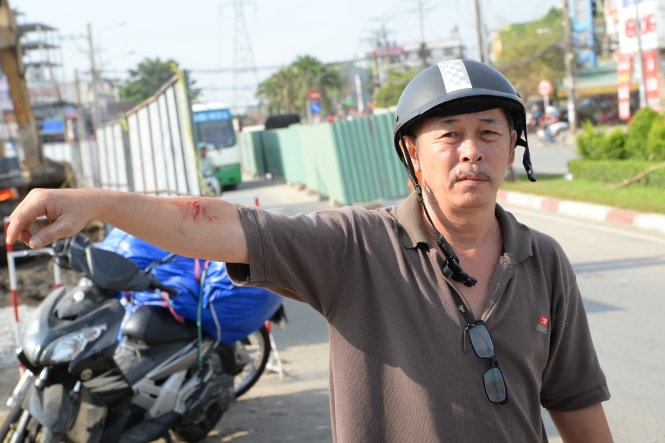 Anh Hùng do đỡ hàng rào chắn không đè em gái cũng đã bị thương ở tay.