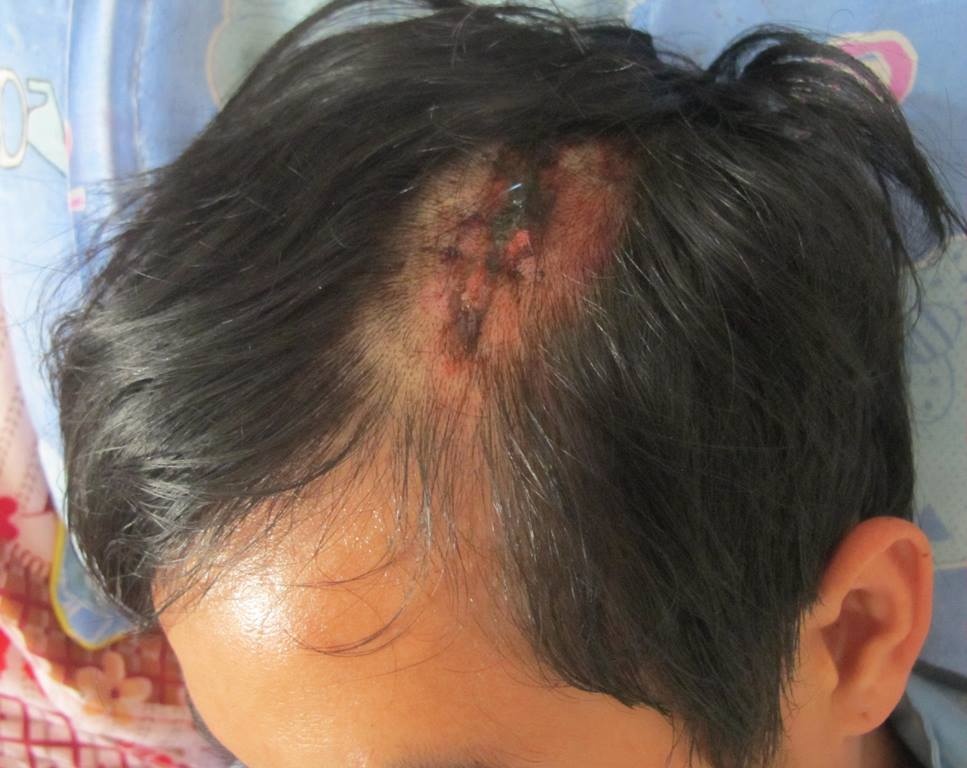 Hanh khach to nha xe dung tuyp danh chan thuong so nao hinh anh