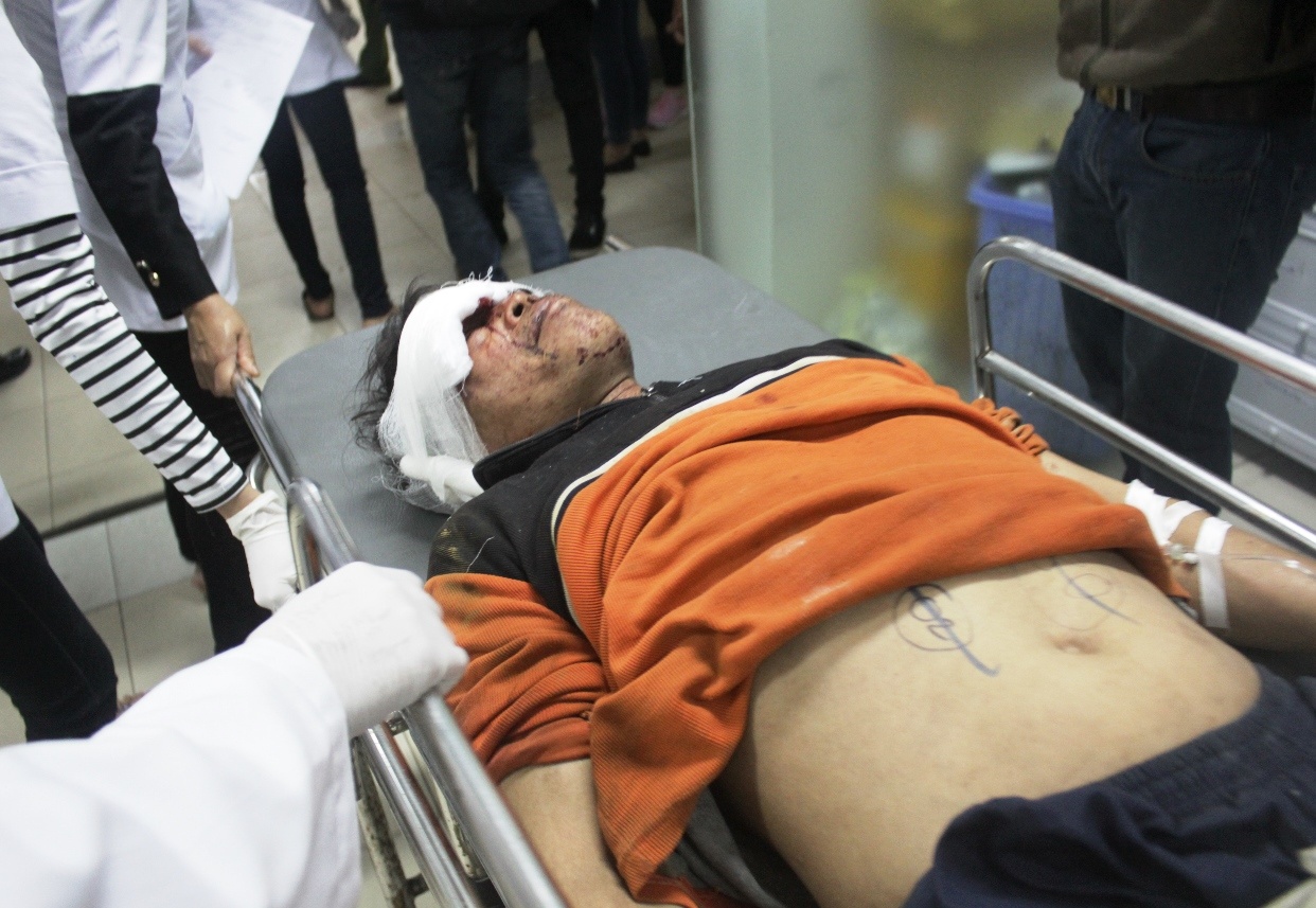 Anh Phan Văn Xô bị chấn thương ở mặt.