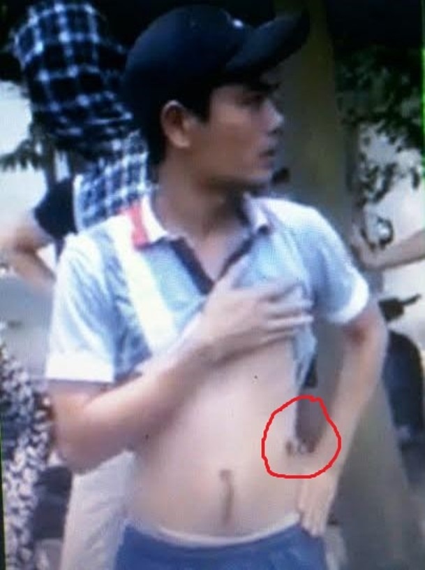 Anh Nghĩa vi phạm giao thông bị thiếu úy Trung bắn đạn cao su vào hông trái. Ảnh: Cắt từ clip.