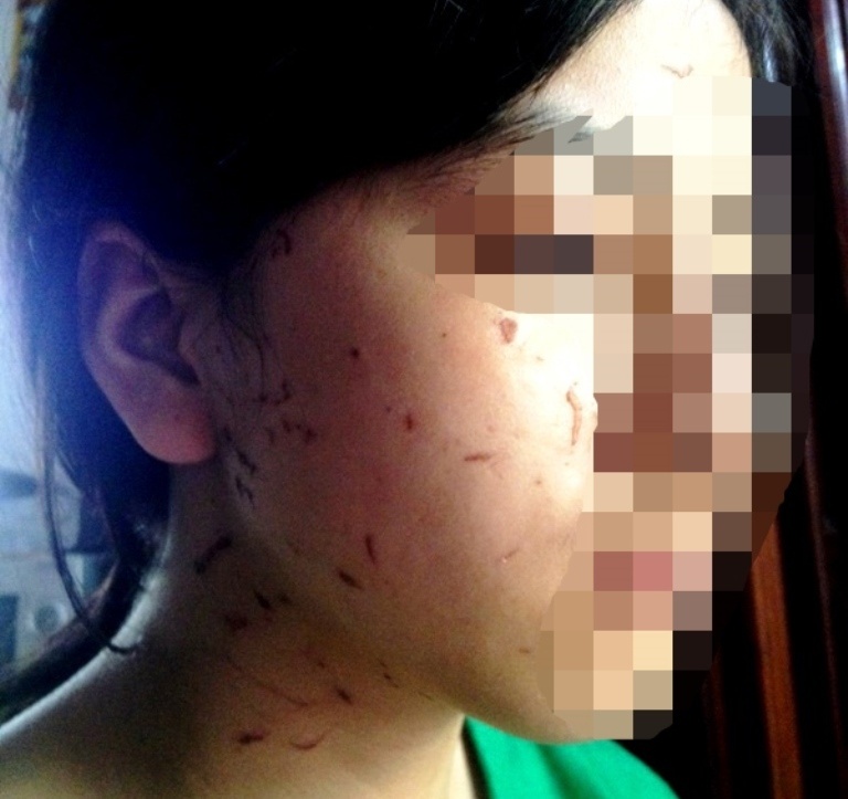 Nu sinh 3 lan bi chan danh chua the den truong hinh anh