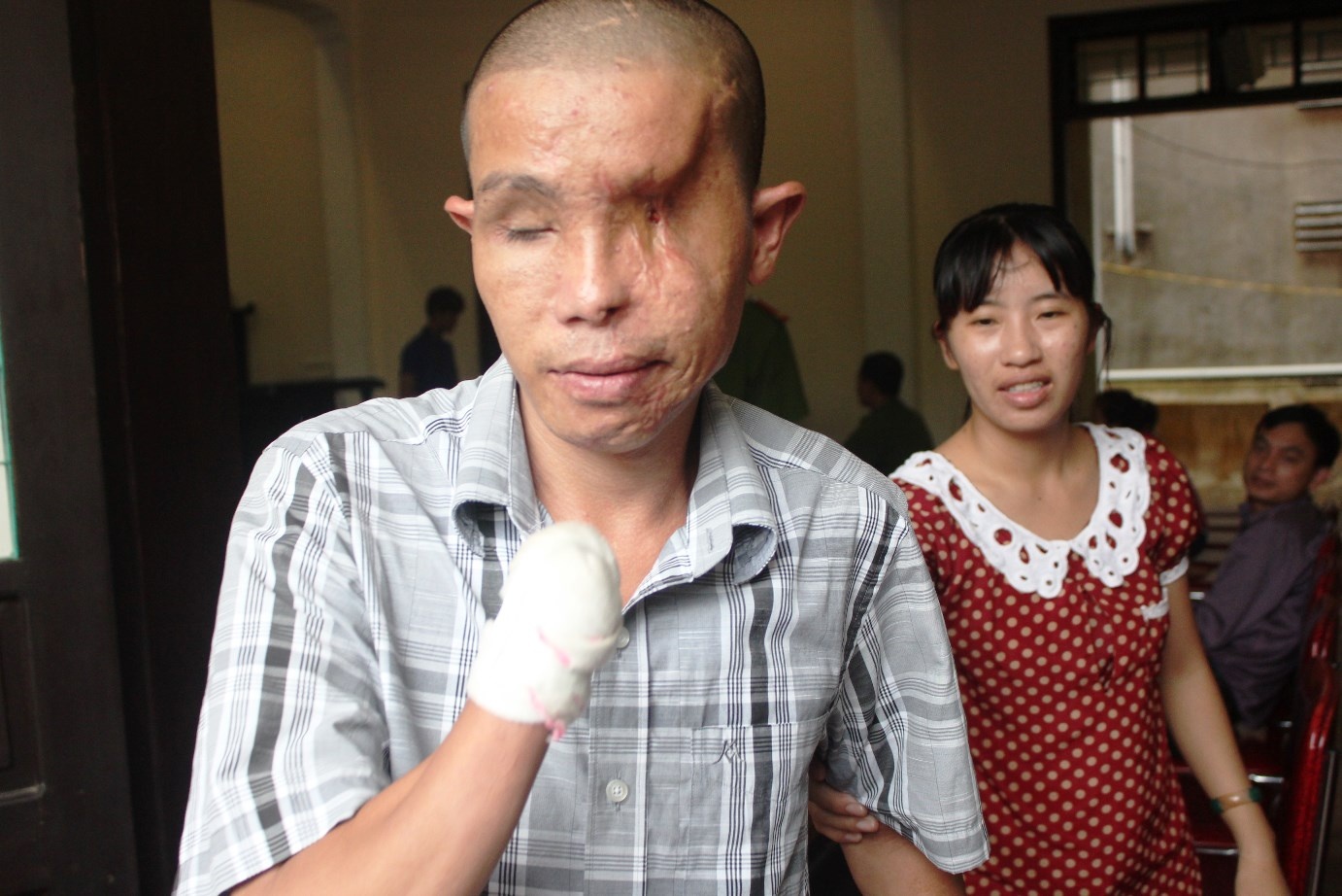 Anh Hảo là người bị thương tật nặng nhất, tổn thất đến 98% sức khỏe. Ảnh: P.H.