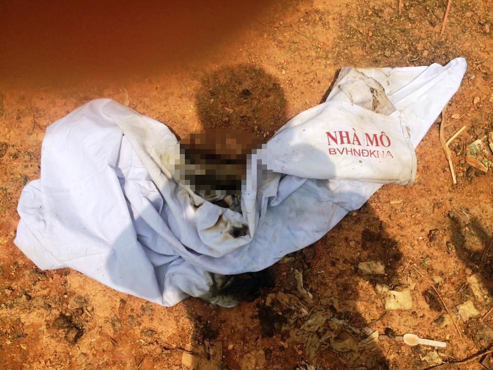 Chan nguoi boc trong mieng vai vut o bai rac hinh anh