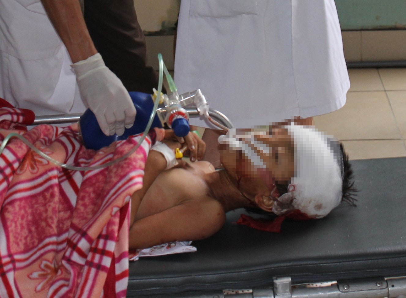 Be trai 4 tuoi bi duong danh chet hinh anh