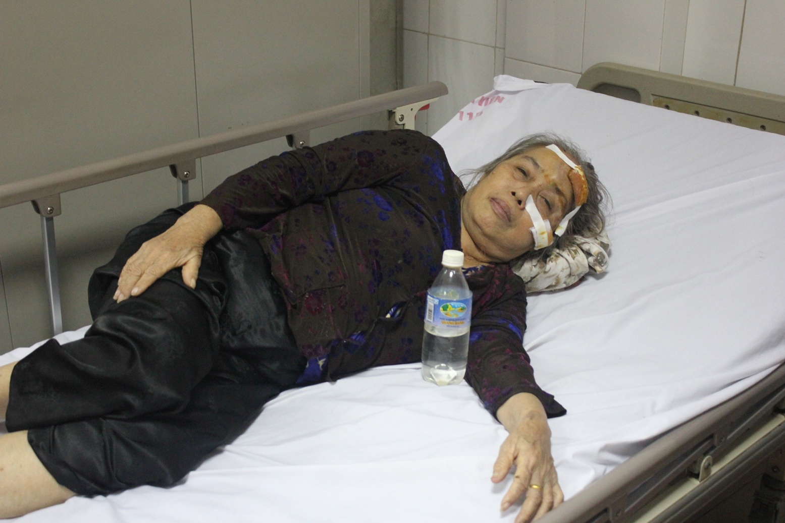 Bà Chính, một trong những người bị thương đang nằm điều trị tại Bệnh viện 115 Nghệ An. Ảnh: N.A.