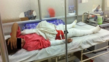 Tuoi xang dot lo banh mi, 4 nguoi bong nang hinh anh