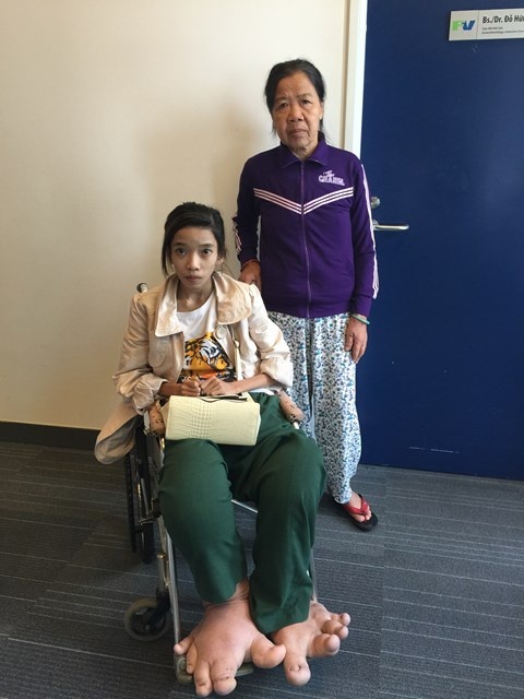 Em Mỹ Son đã phải mang khối u khủng này 20 năm qua.