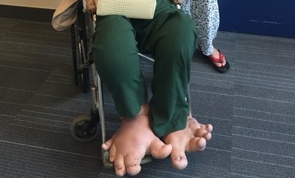 Thieu nu 20 tuoi khon kho vi doi chan khong lo hinh anh