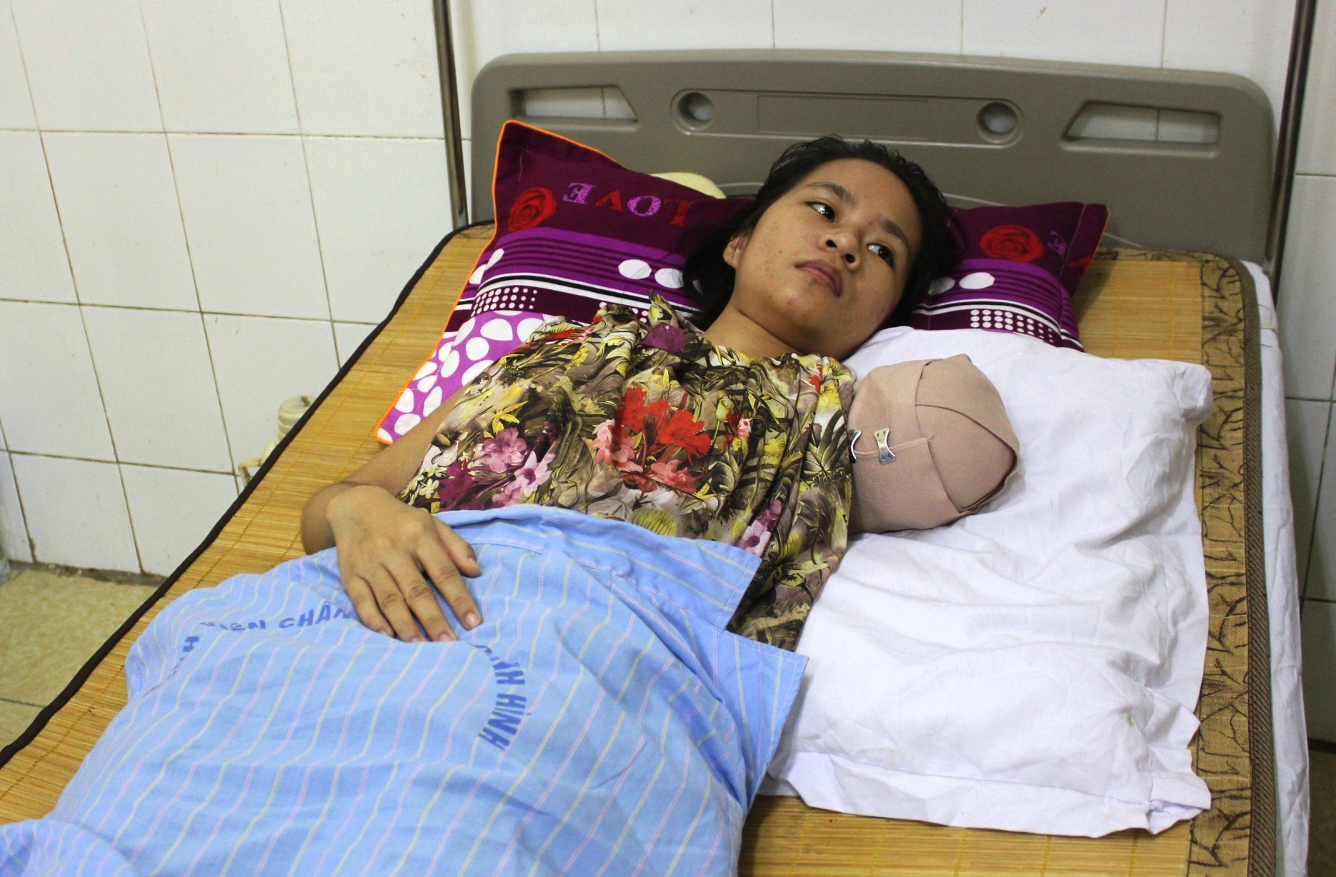 Sau 25 ngày nằm điều trị vết thương thì chị Yến đã được xuất viện trở về nhà. Ảnh: Phạm Hòa.