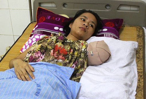 Nu du khach bi ho can dut canh tay xuat vien hinh anh