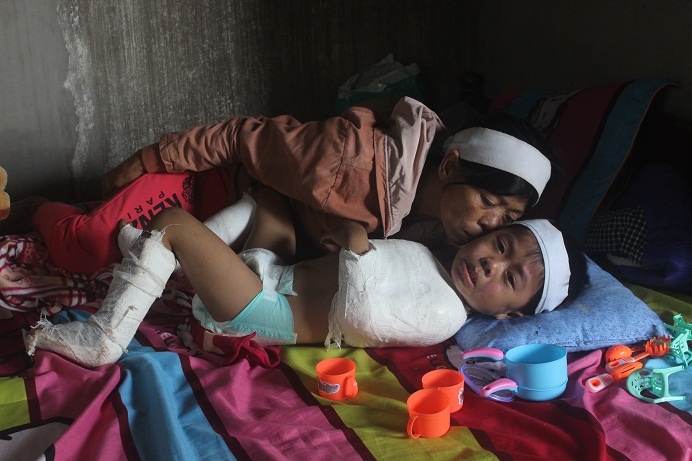 Thuong chau be 4 tuoi mat ca bo lan me sau tai nan hinh anh