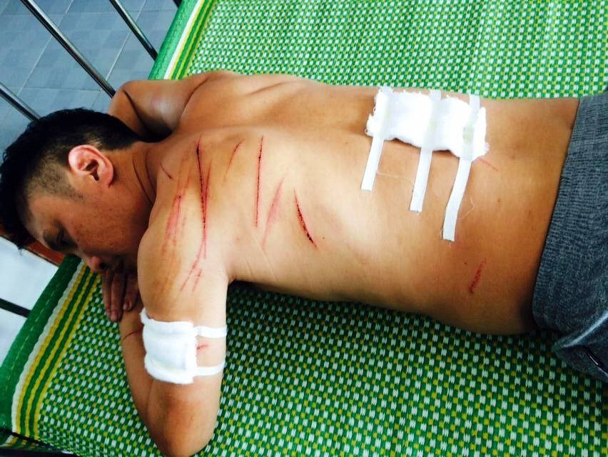 truy sat ban nhau anh 1