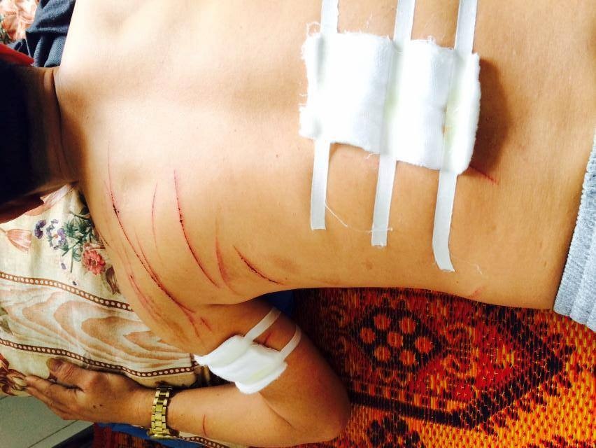 Truy sat ban nhau vi mau thuan tu mot nam truoc hinh anh