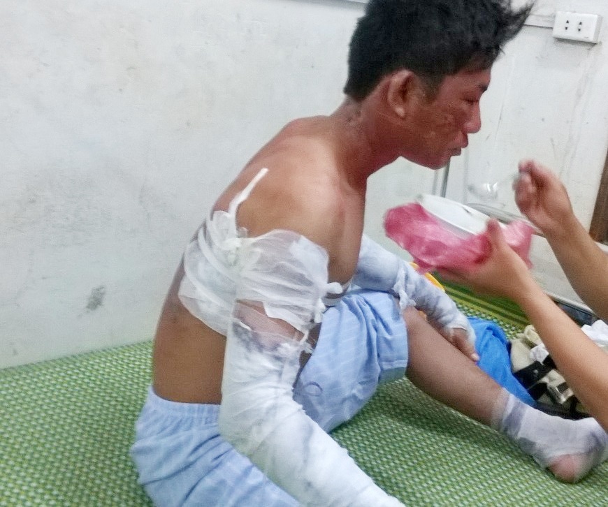 No lon tai nha may tinh bot san, 4 cong nhan nhap vien hinh anh