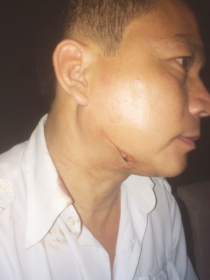 Cướp xe taxi ảnh 2 Cuop xe taxi anh 2