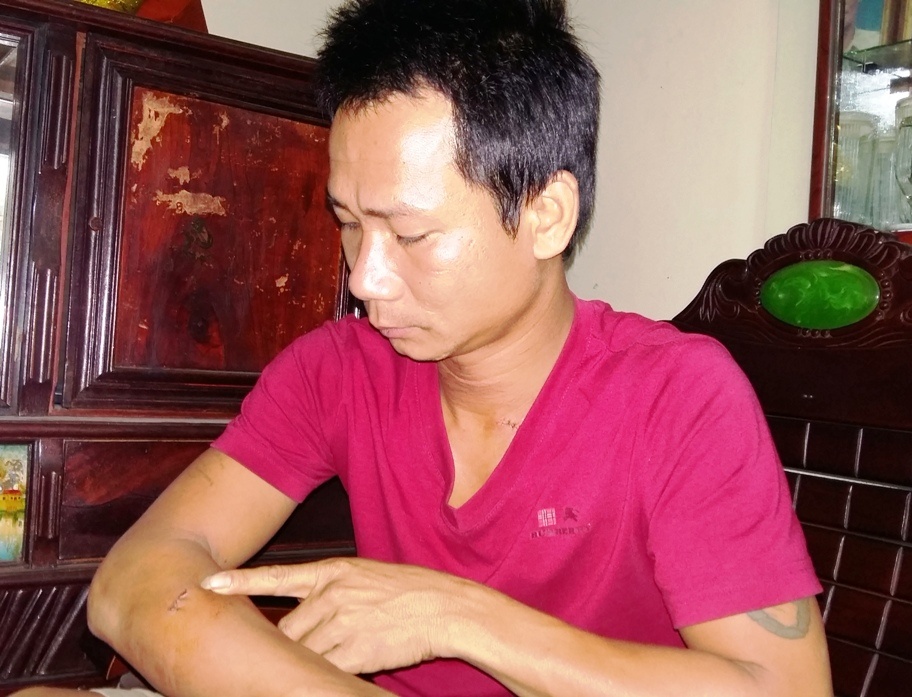 'Khi bi bat lam con tin, toi nghi minh se chet' hinh anh