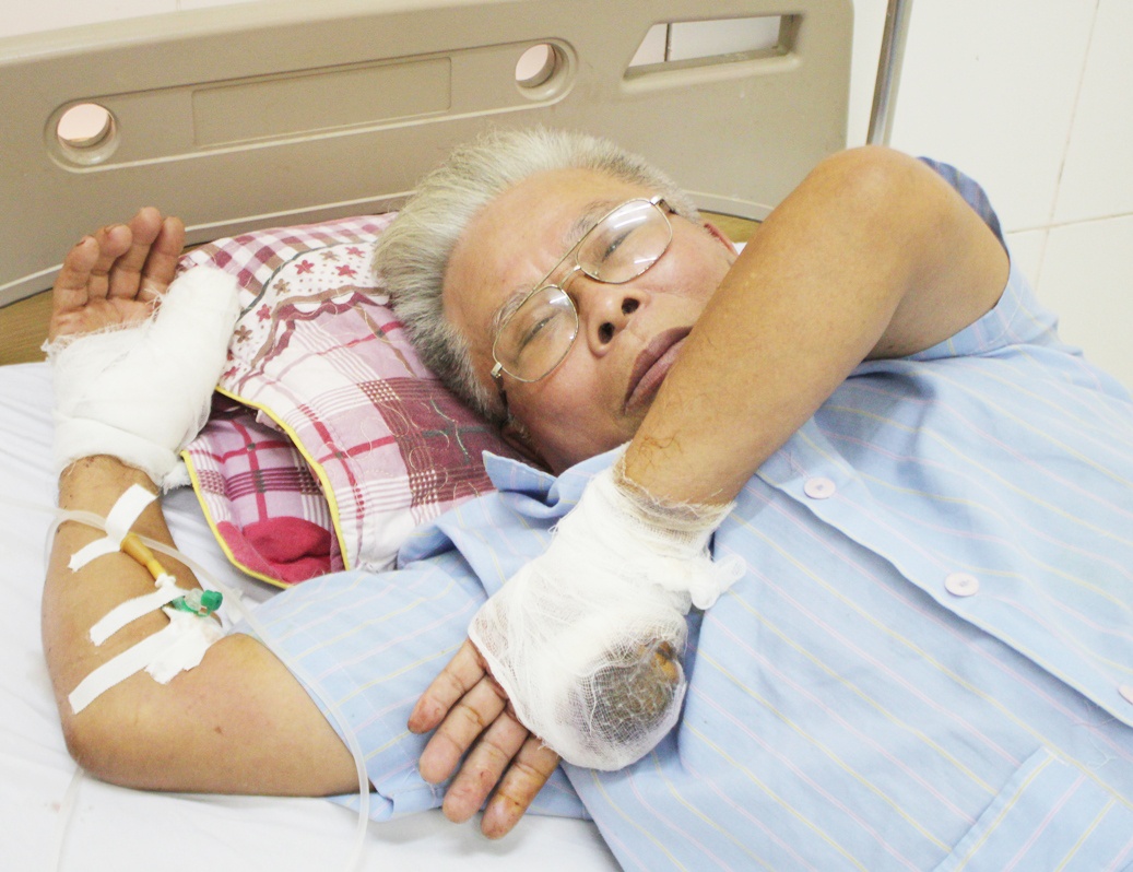 Ong lao viet don to cao bi con do chem dut lia ngon tay hinh anh