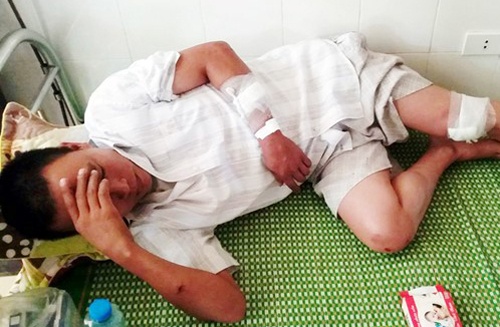 Tai xe xe khach truy sat nhau tren quoc lo hinh anh