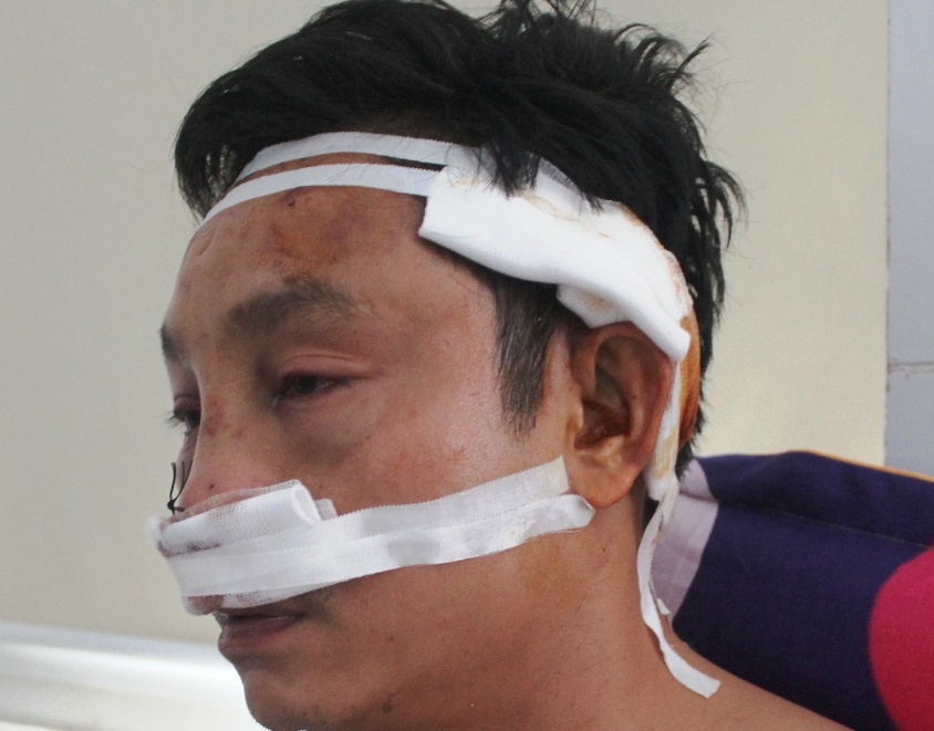 Nhom con do dung sung thanh toan nguoi tai quan ca phe hinh anh