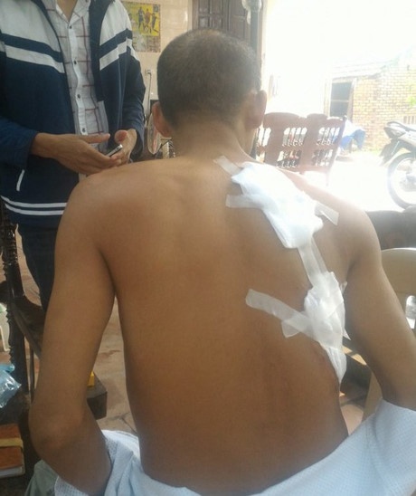 Chem nhau tai dam cuoi anh 1