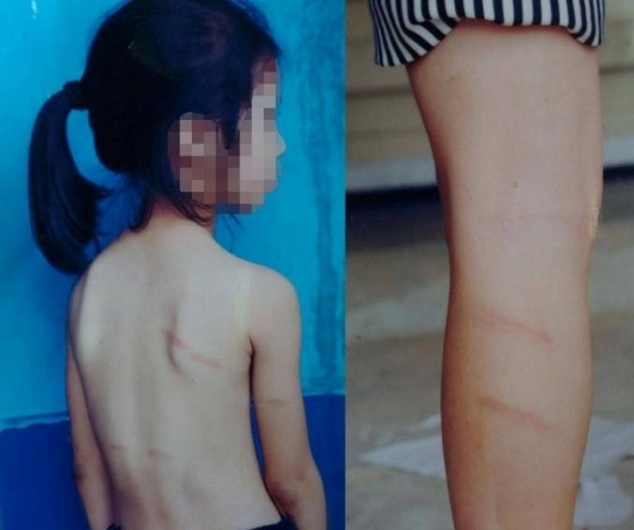 Hoc sinh lop 1 khong lam duoc bai to bi co giao danh hinh anh