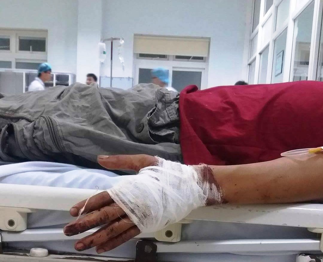 Chem gan dut lia ban tay trai doi phuong vi tranh gianh khach hinh anh