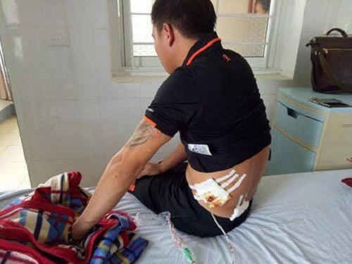 xả súng tại quán karaoke ảnh 2 xa sung tai quan karaoke anh 2