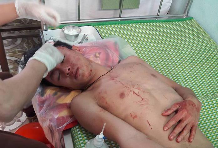 xông vào trường hành hung thầy và trò ảnh 1 xong vao truong hanh hung thay va tro anh 1