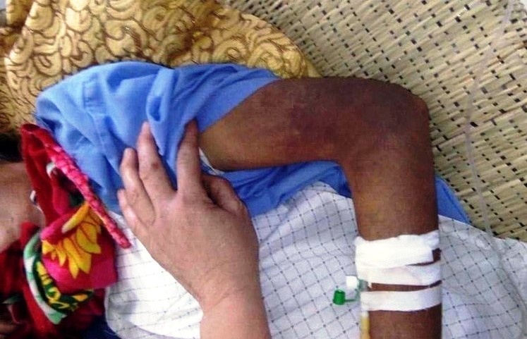 Con trai danh bo gay xuong suon phai nhap vien cap cuu hinh anh