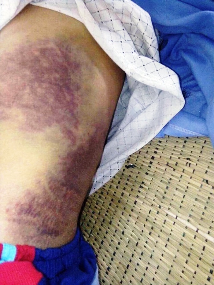 con trai đánh cha gãy xương sườn ảnh 1 con trai danh cha gay xuong suon anh 1