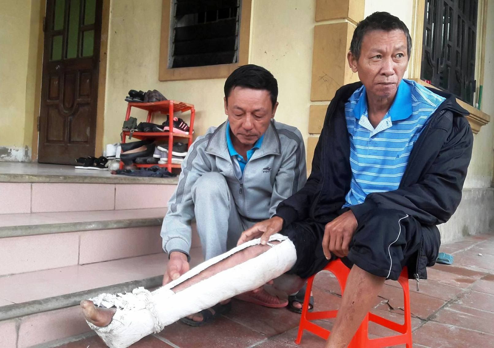 bo bi con trai danh gay xuong anh 4