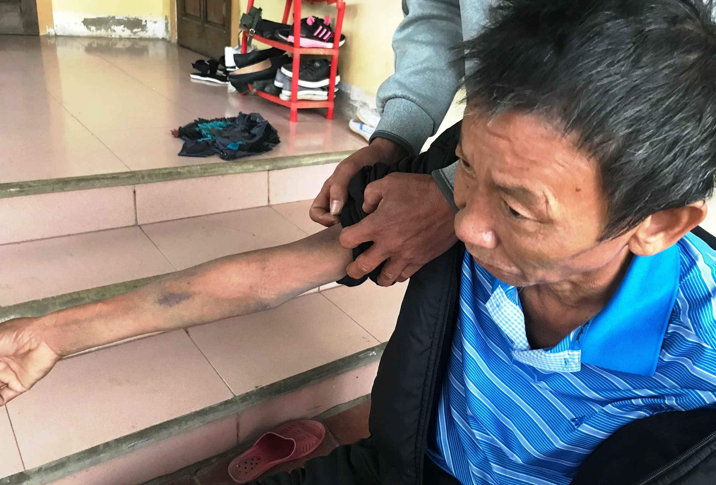 Hoan canh bi dat cua nguoi dan ong bi con trai danh dap tan nhan hinh anh