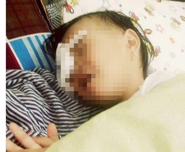 Be gai 2 tuoi bi ga choi mo mu mot mat hinh anh