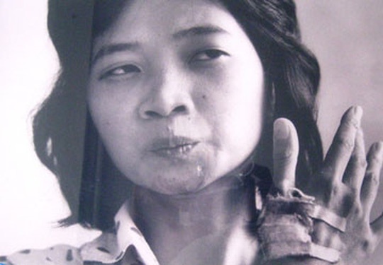 Chuyen 'chet di song lai' cua mot nu biet dong hinh anh