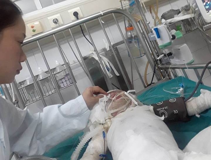 Be gai hon 2 tuoi bong nang khi roi vao ho voi hinh anh