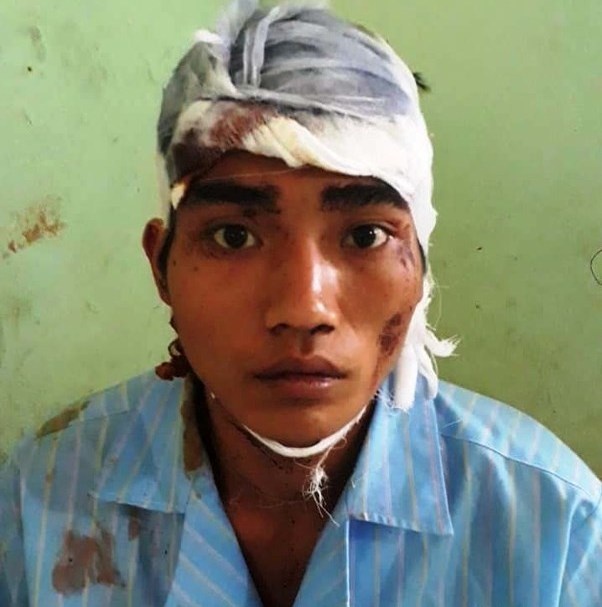 Ảo giác ảnh 2 Ao giac anh 2