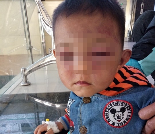 Be trai 2 tuoi bi bo duong bao hanh hinh anh