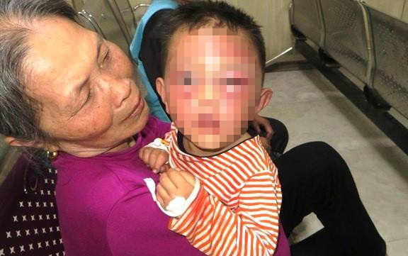 Bạo hành trẻ ảnh 1 Bao hanh tre anh 1