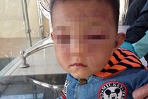 Khong xu ly hinh su vu bo duong bao hanh be trai 2 tuoi hinh anh