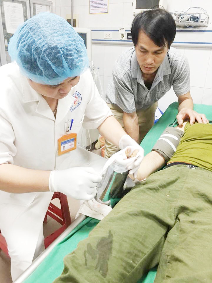 máy xay thịt cuốn nát bàn tay ảnh 1 may xay thit cuon nat ban tay anh 1