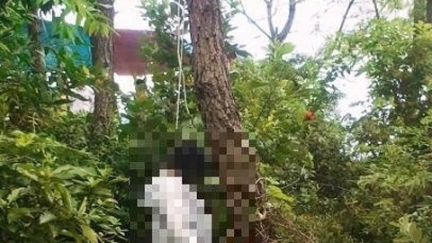 Khai quat tu thi nu ke toan truong benh vien de dieu tra hinh anh