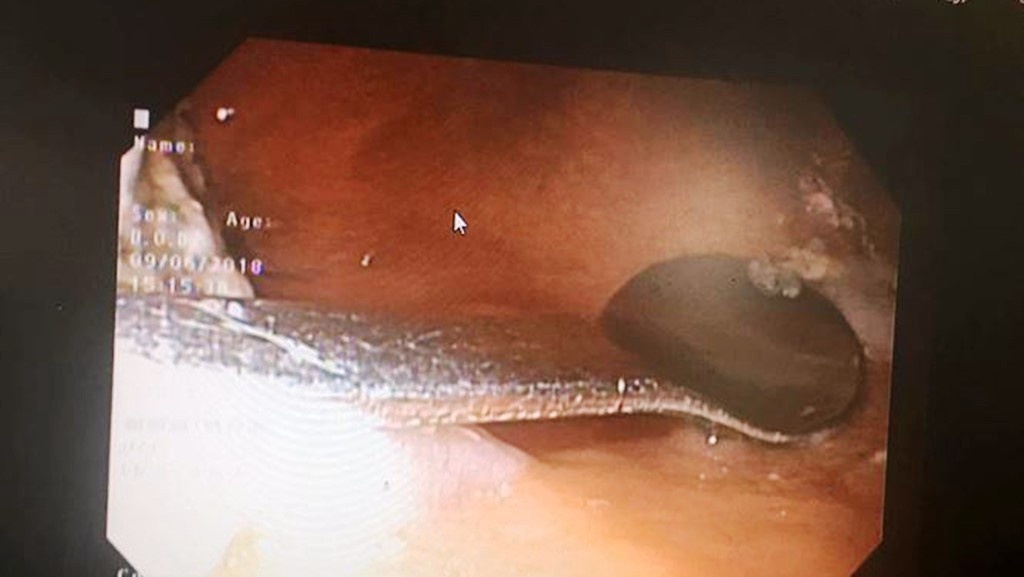 phau thuat noi soi anh 1